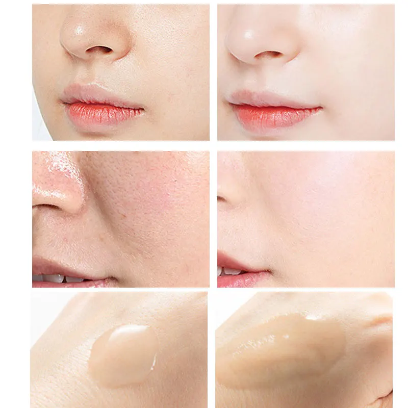 Peeling Serum Salicylsäure Ges – Niacinamide Pore Shrinking Essence Bewertung und Preis